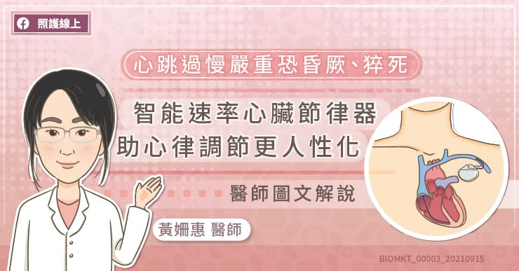 嚴重心跳過慢恐致昏厥、猝死，智能速率心臟節律器有助心律調節更人性化。看醫師圖文解說