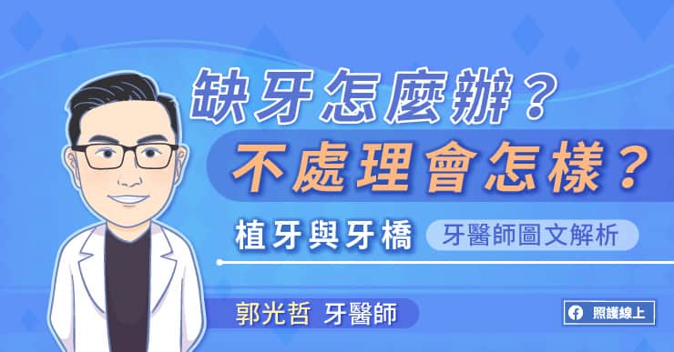 缺牙怎麼辦？不處理會怎樣？看牙醫師圖文解析植牙與牙橋