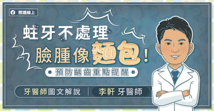 蛀牙不處理，臉腫像麵包！牙醫師圖文解說如何預防齲齒