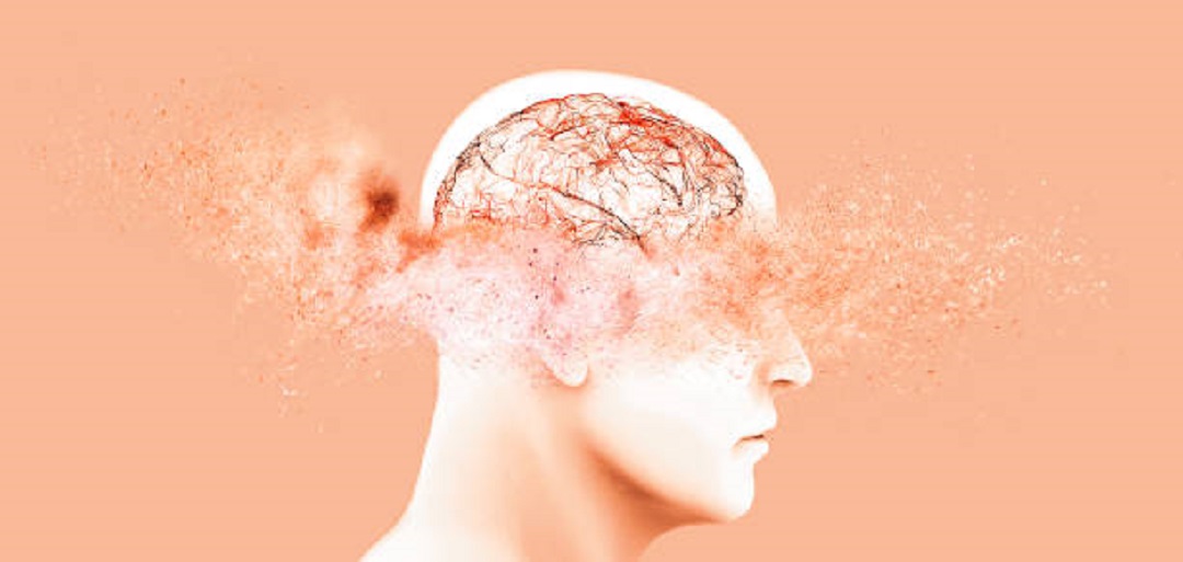 打通腦血管狹窄，搶救腦中風